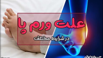 علت ورم پا
