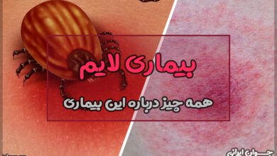 بیماری لایم