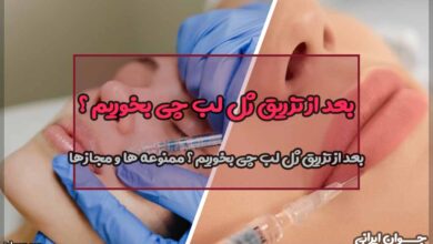 بعد از تزریق ژل لب چی بخوریم ؟ ممنوعه ها و مجازها