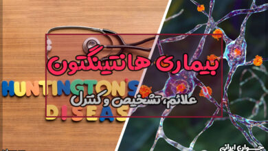 بیماری هانتینگتون
