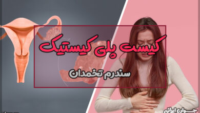 کیست پلی کیستیک