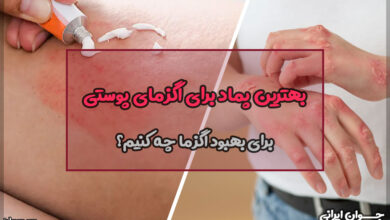 بهترین پماد برای اگزمای پوستی