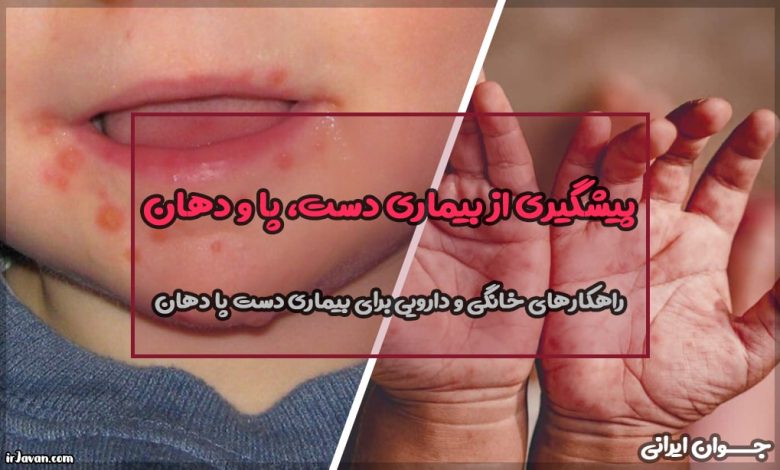 بیماری دست، پا و دهان: علائم، تصاویر و راههای تشخیص