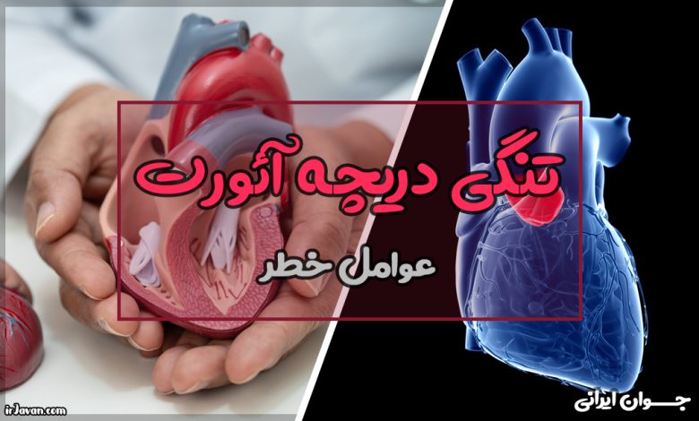 تنگی دریچه آئورت
