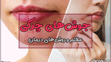 جوش چرکی چیست؟