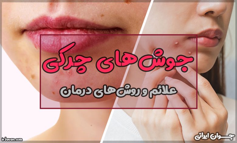 جوش چرکی چیست؟