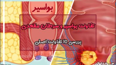 تفاوت بواسیر و سرطان مقعدی