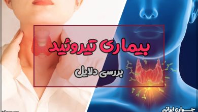 دلیل بیماری تیروئید چیست؟