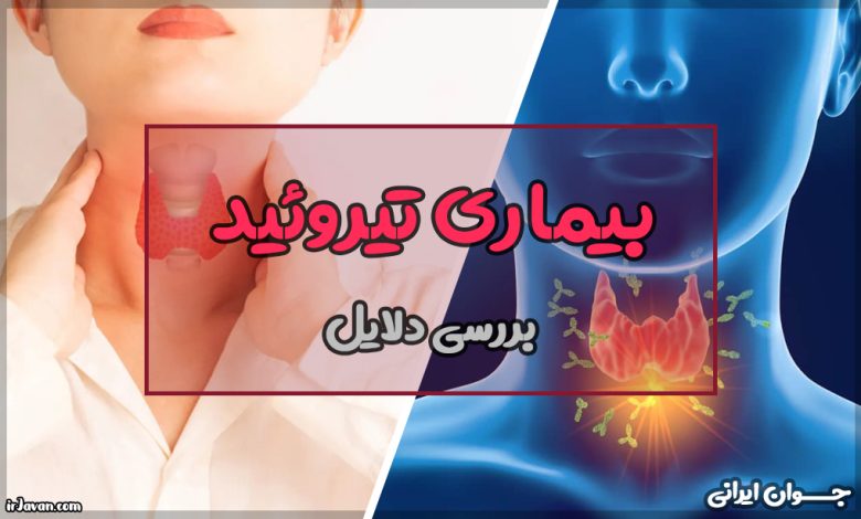 دلیل بیماری تیروئید چیست؟