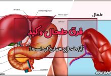 فرق طحال و کبد
