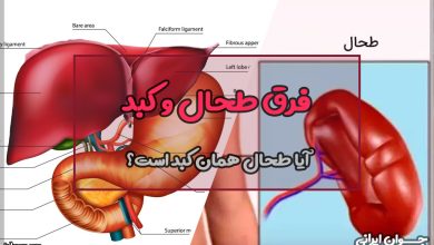 فرق طحال و کبد