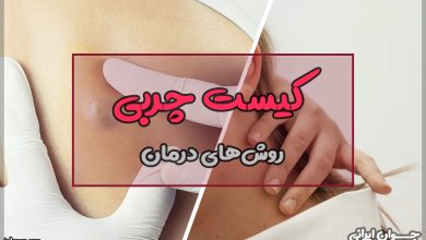 کیست چربی چیست؟