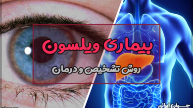 بیماری ویلسون
