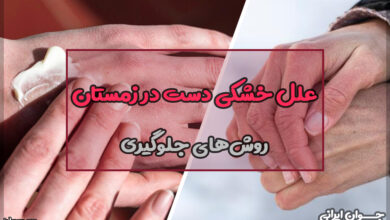 علل خشکی دست در زمستان