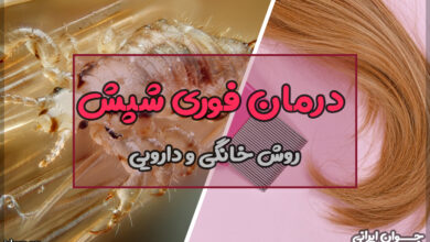 درمان فوری شپش در یک شب