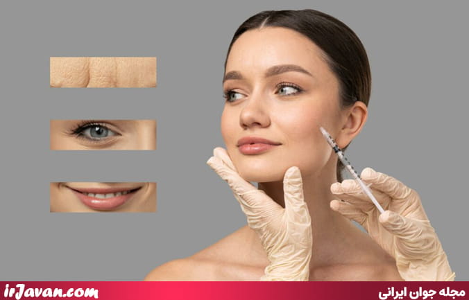 مزوتراپی صورت چیست؟ نکات مهم قبل و بعد از تزریق