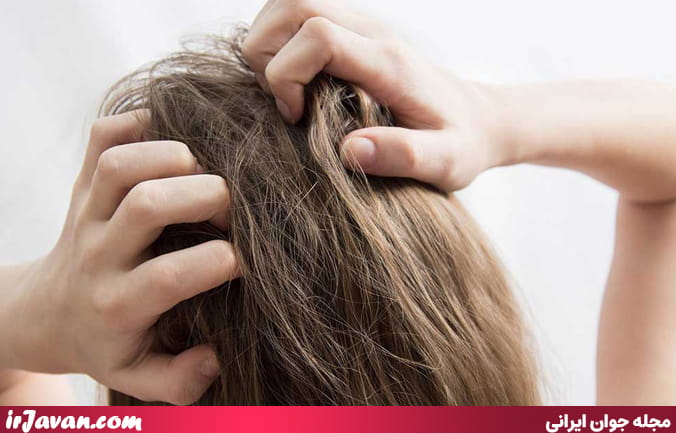 علت خارش پوست سر (از خشکی ساده تا بیماری‌های جدی)