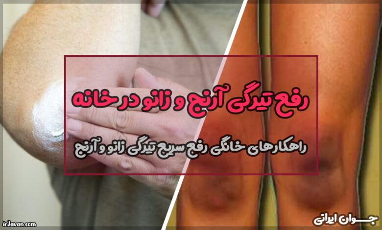 رفع تیرگی آرنج و زانو در خانه (از علت تا درمان)
